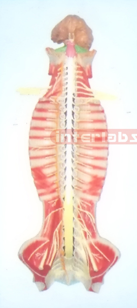 SMALL HANGING HUMAN SPINAL CORD MODEL IN SPINAL CANAL